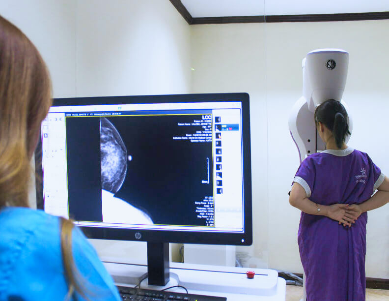 Mammography